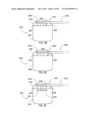 GROUNDING OF A SHIELD WITHIN AN IMPLANTABLE MEDICAL LEAD diagram and image