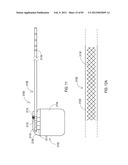 GROUNDING OF A SHIELD WITHIN AN IMPLANTABLE MEDICAL LEAD diagram and image