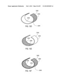 GROUNDING OF A SHIELD WITHIN AN IMPLANTABLE MEDICAL LEAD diagram and image