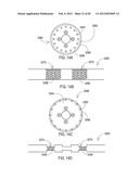 GROUNDING OF A SHIELD WITHIN AN IMPLANTABLE MEDICAL LEAD diagram and image