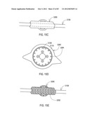 GROUNDING OF A SHIELD WITHIN AN IMPLANTABLE MEDICAL LEAD diagram and image