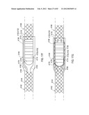 GROUNDING OF A SHIELD WITHIN AN IMPLANTABLE MEDICAL LEAD diagram and image