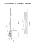 GROUNDING OF A SHIELD WITHIN AN IMPLANTABLE MEDICAL LEAD diagram and image