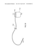 GROUNDING OF A SHIELD WITHIN AN IMPLANTABLE MEDICAL LEAD diagram and image