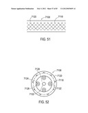 GROUNDING OF A SHIELD WITHIN AN IMPLANTABLE MEDICAL LEAD diagram and image