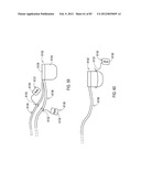 GROUNDING OF A SHIELD WITHIN AN IMPLANTABLE MEDICAL LEAD diagram and image