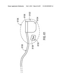 GROUNDING OF A SHIELD WITHIN AN IMPLANTABLE MEDICAL LEAD diagram and image