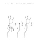 GROUNDING OF A SHIELD WITHIN AN IMPLANTABLE MEDICAL LEAD diagram and image