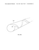 GROUNDING OF A SHIELD WITHIN AN IMPLANTABLE MEDICAL LEAD diagram and image