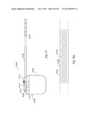 GROUNDING OF A SHIELD WITHIN AN IMPLANTABLE MEDICAL LEAD diagram and image