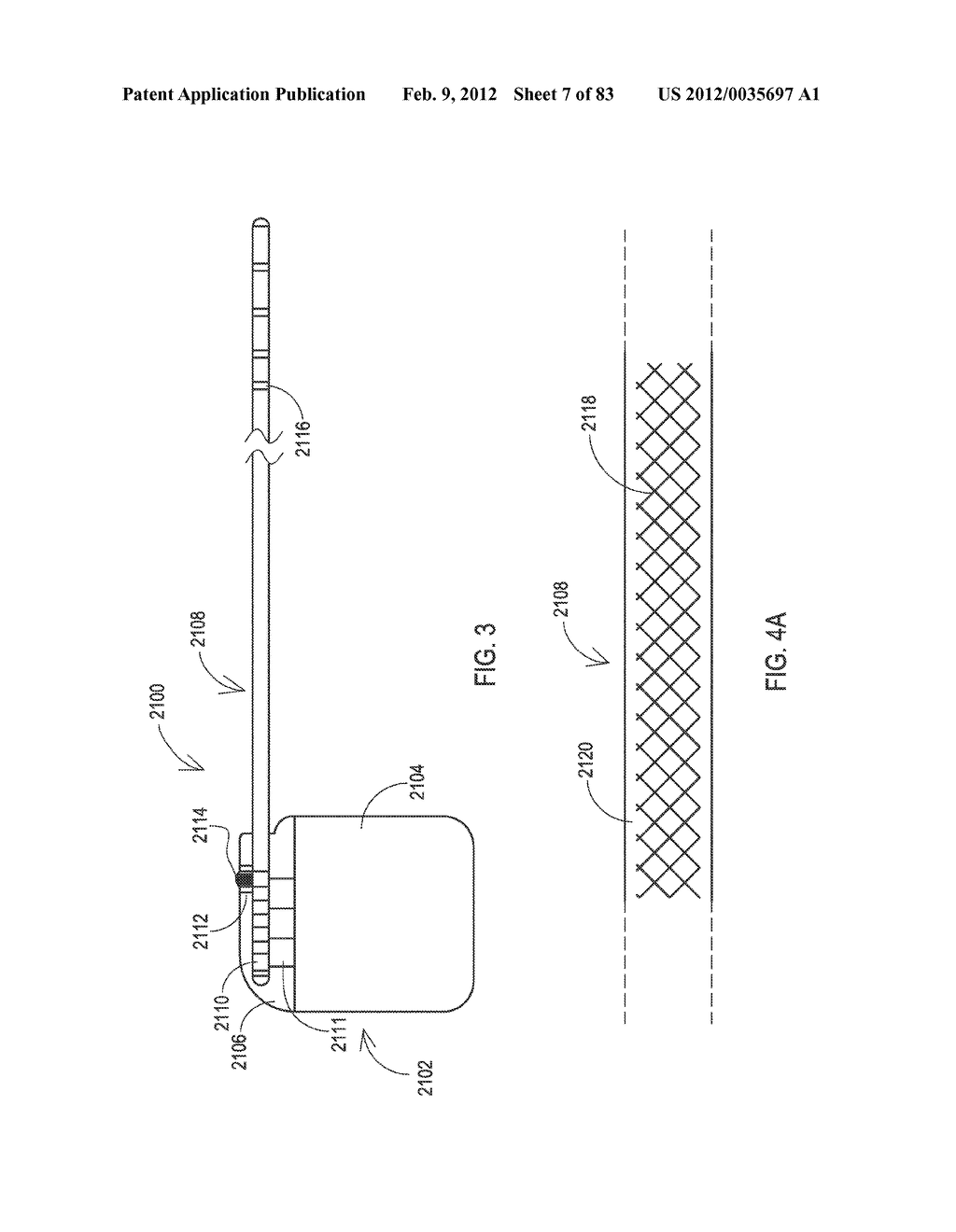 SHIELDED IMPLANTABLE MEDICAL LEAD WITH GUARDED TERMINATION - diagram, schematic, and image 08