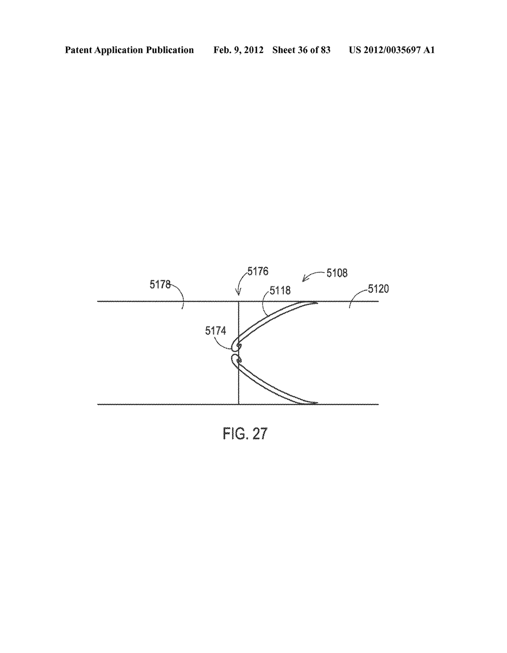 SHIELDED IMPLANTABLE MEDICAL LEAD WITH GUARDED TERMINATION - diagram, schematic, and image 37