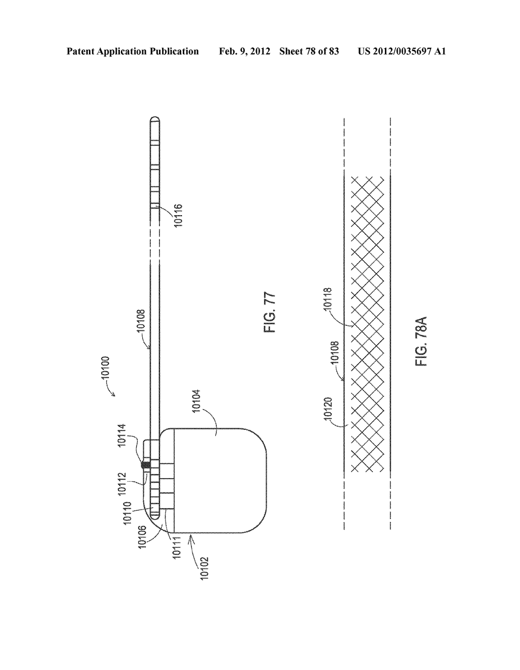 SHIELDED IMPLANTABLE MEDICAL LEAD WITH GUARDED TERMINATION - diagram, schematic, and image 79