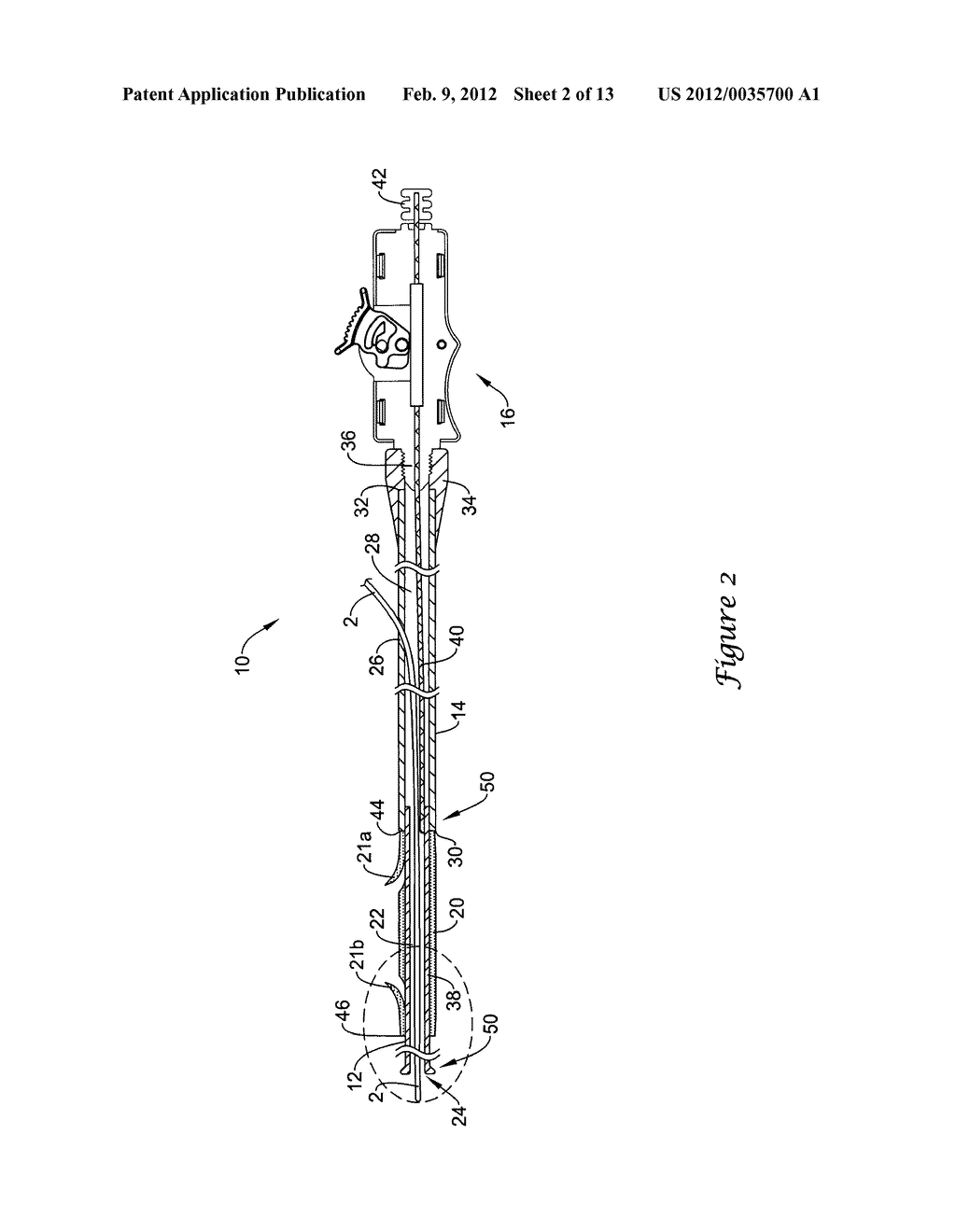 STENT DELIVERY SYSTEM - diagram, schematic, and image 03