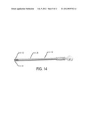 STENT FOR VALVE REPLACEMENT diagram and image