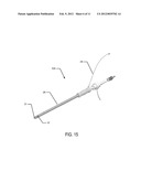 STENT FOR VALVE REPLACEMENT diagram and image