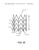 STENT FOR VALVE REPLACEMENT diagram and image