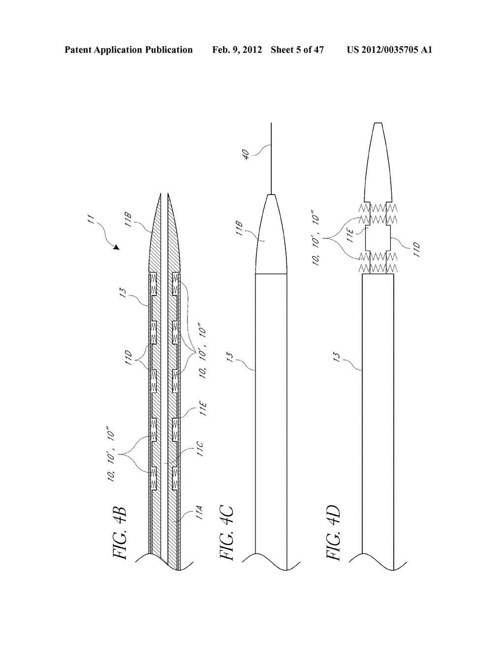 DEPLOYMENT DEVICE FOR PLACEMENT OF MULTIPLE INTRALUMINAL SURGICAL STAPLES - diagram, schematic, and image 06