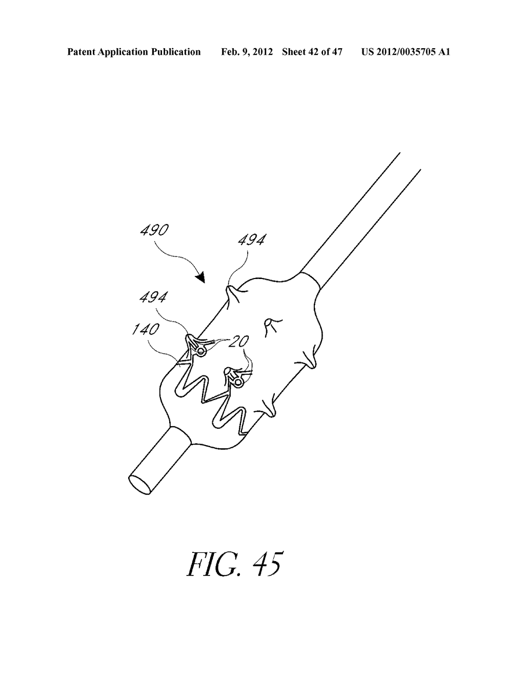 DEPLOYMENT DEVICE FOR PLACEMENT OF MULTIPLE INTRALUMINAL SURGICAL STAPLES - diagram, schematic, and image 43