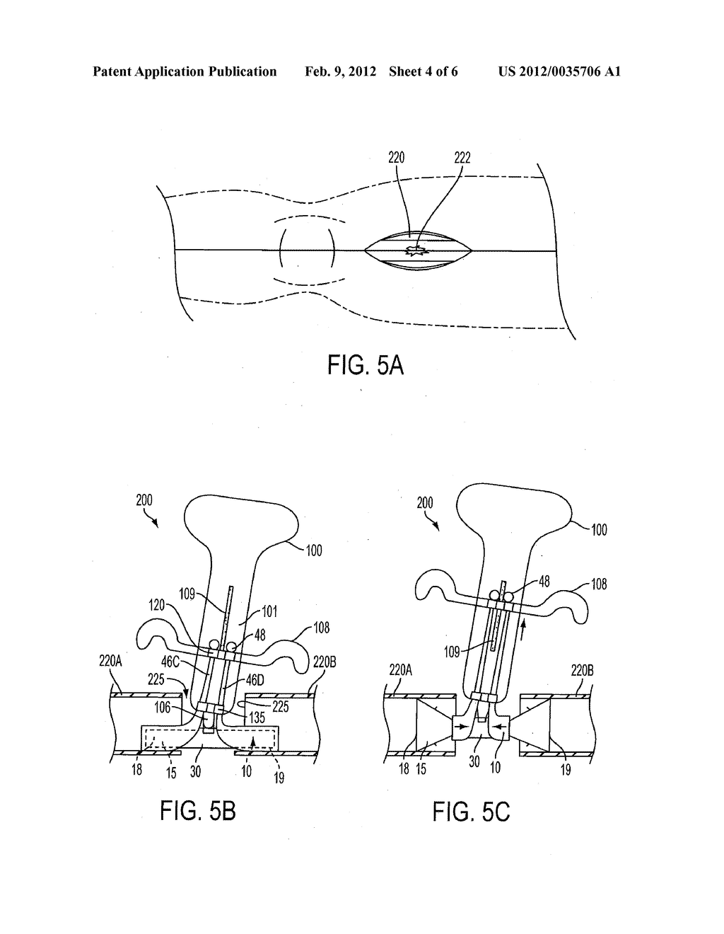 BLOOD PERFUSION DEVICE DELIVERY SYSTEM - diagram, schematic, and image 05