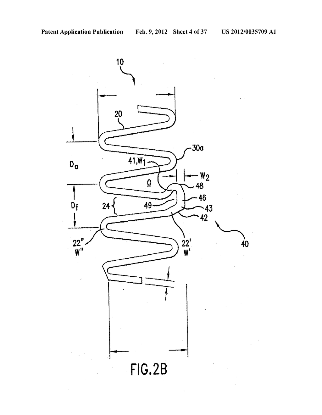 ENDOPROSTHESIS HAVING FOOT EXTENSIONS - diagram, schematic, and image 05