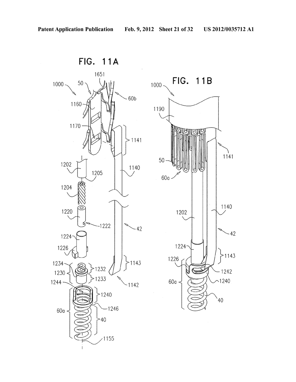 METHOD AND APPARATUS FOR TRICUSPID VALVE REPAIR USING TENSION - diagram, schematic, and image 22