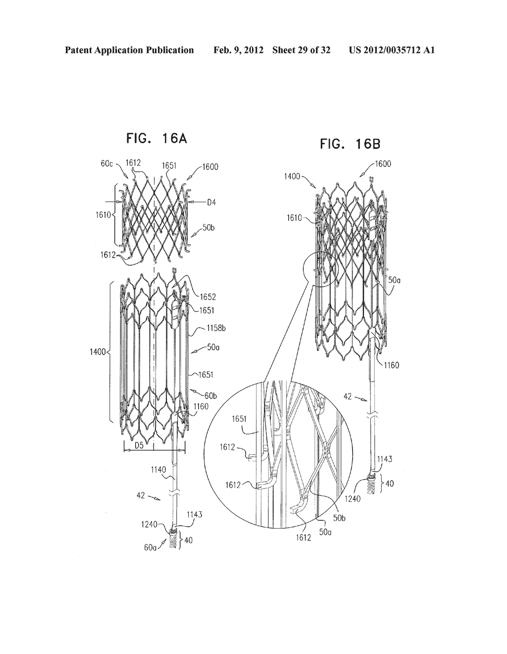 METHOD AND APPARATUS FOR TRICUSPID VALVE REPAIR USING TENSION - diagram, schematic, and image 30