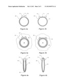 Stent Graft Having A Marker And A Reinforcing And Marker Ring diagram and image