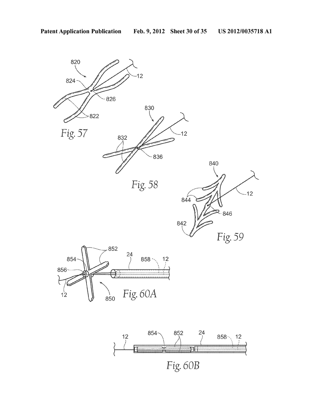 DEVICES, SYSTEMS, AND METHODS FOR RESHAPING A HEART VALVE ANNULUS - diagram, schematic, and image 31