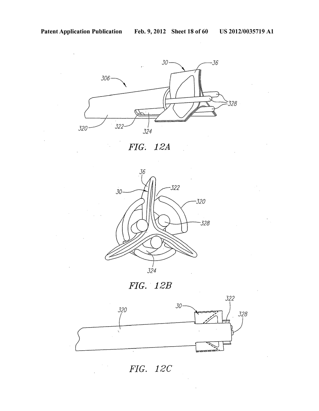 Prosthetic Heart Valves, Support Structures and Systems and Methods for     Implanting the Same - diagram, schematic, and image 19