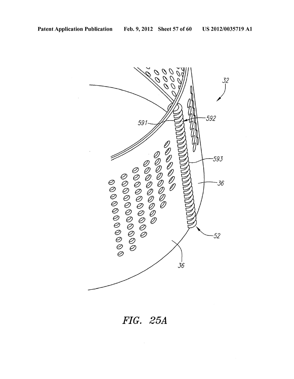 Prosthetic Heart Valves, Support Structures and Systems and Methods for     Implanting the Same - diagram, schematic, and image 58