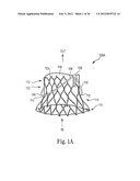 Mitral Prosthesis and Methods for Implantation diagram and image