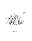 Mitral Prosthesis and Methods for Implantation diagram and image