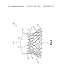 Mitral Prosthesis and Methods for Implantation diagram and image