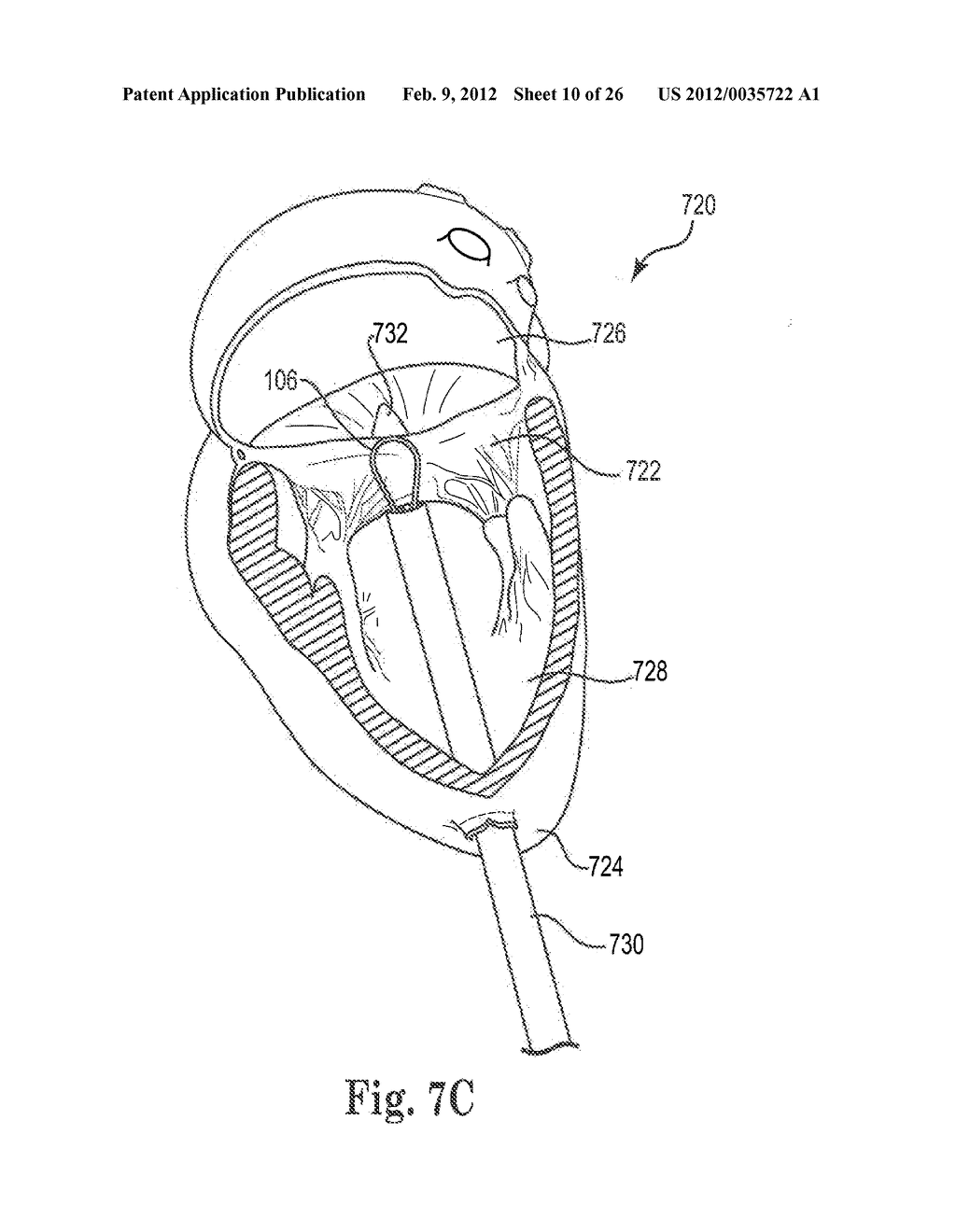 Mitral Prosthesis and Methods for Implantation - diagram, schematic, and image 11