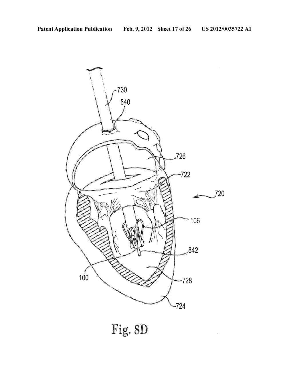 Mitral Prosthesis and Methods for Implantation - diagram, schematic, and image 18