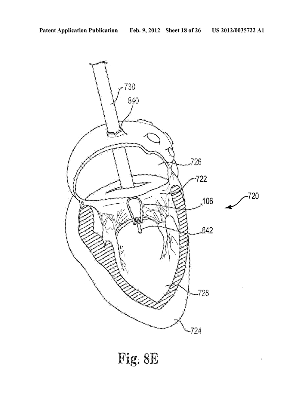 Mitral Prosthesis and Methods for Implantation - diagram, schematic, and image 19