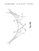 Mitral Prosthesis and Methods for Implantation diagram and image