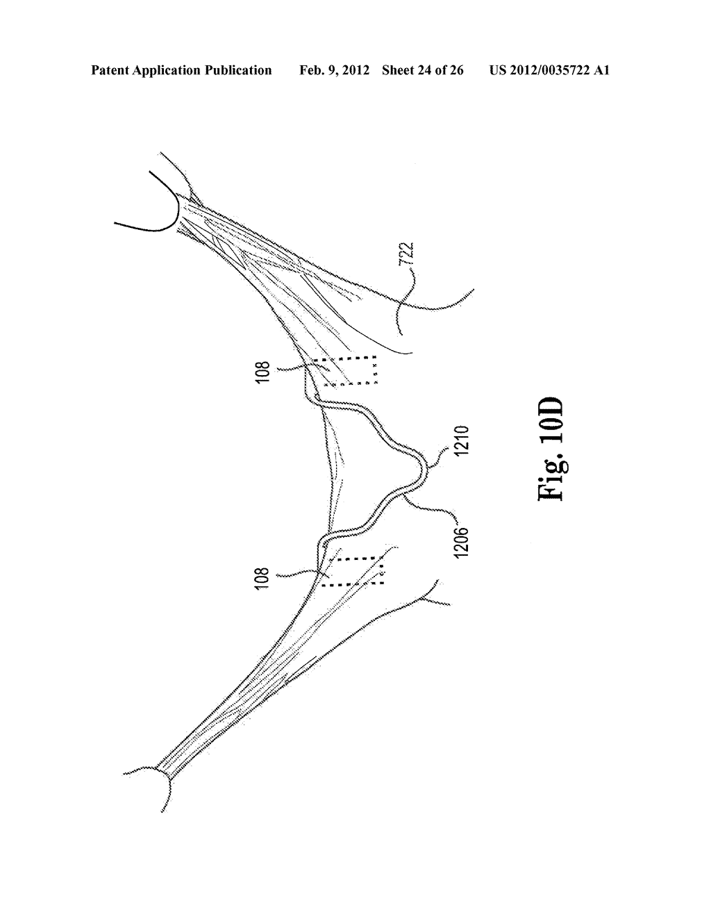 Mitral Prosthesis and Methods for Implantation - diagram, schematic, and image 25