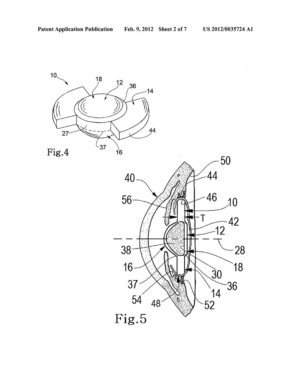 Accommodating intraocular lens and methods of use - diagram, schematic, and image 03