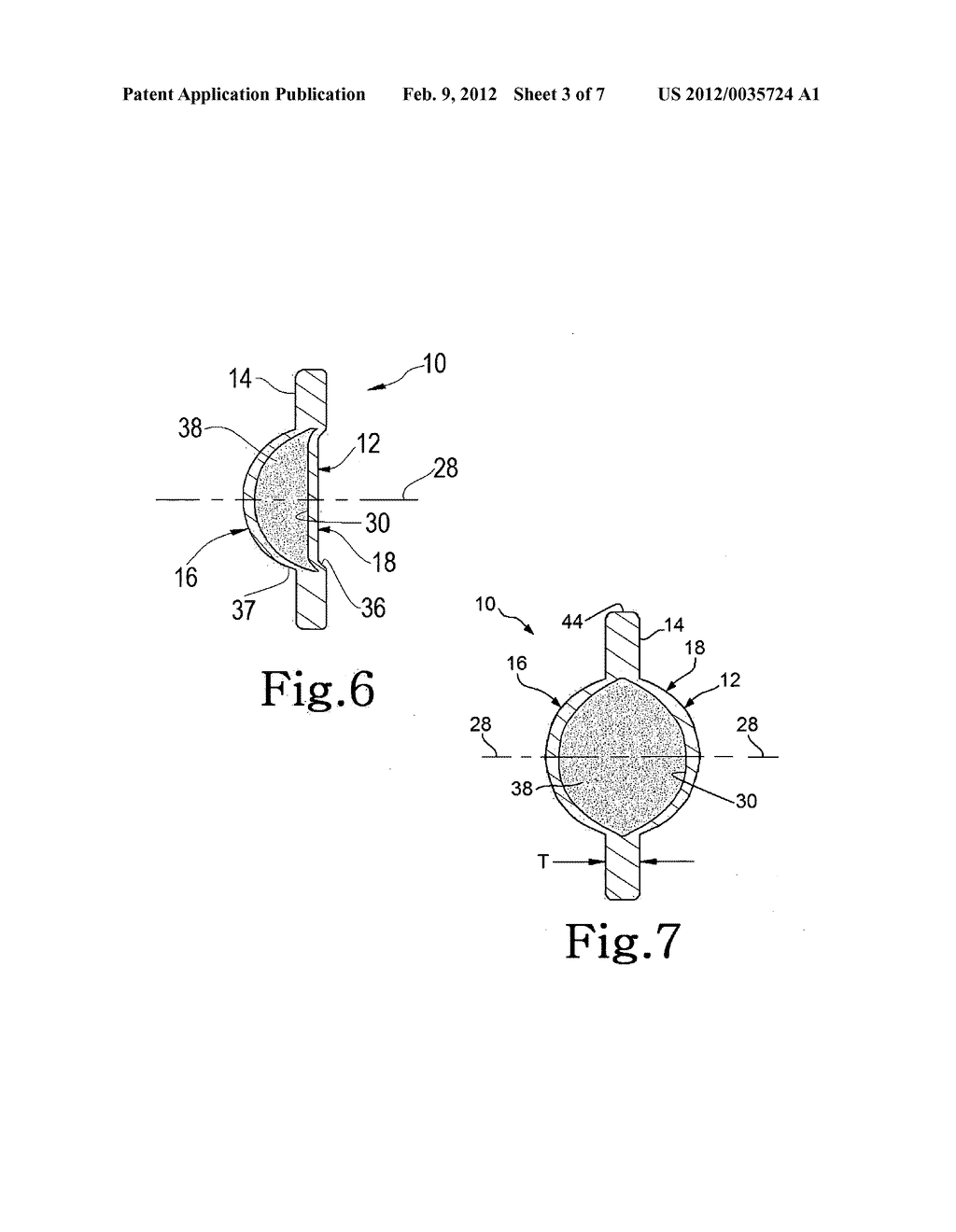 Accommodating intraocular lens and methods of use - diagram, schematic, and image 04