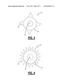 SURGICAL IMPLANT DEVICE FOR THE TRANSLATION AND FUSION OF A FACET JOINT OF     THE SPINE diagram and image