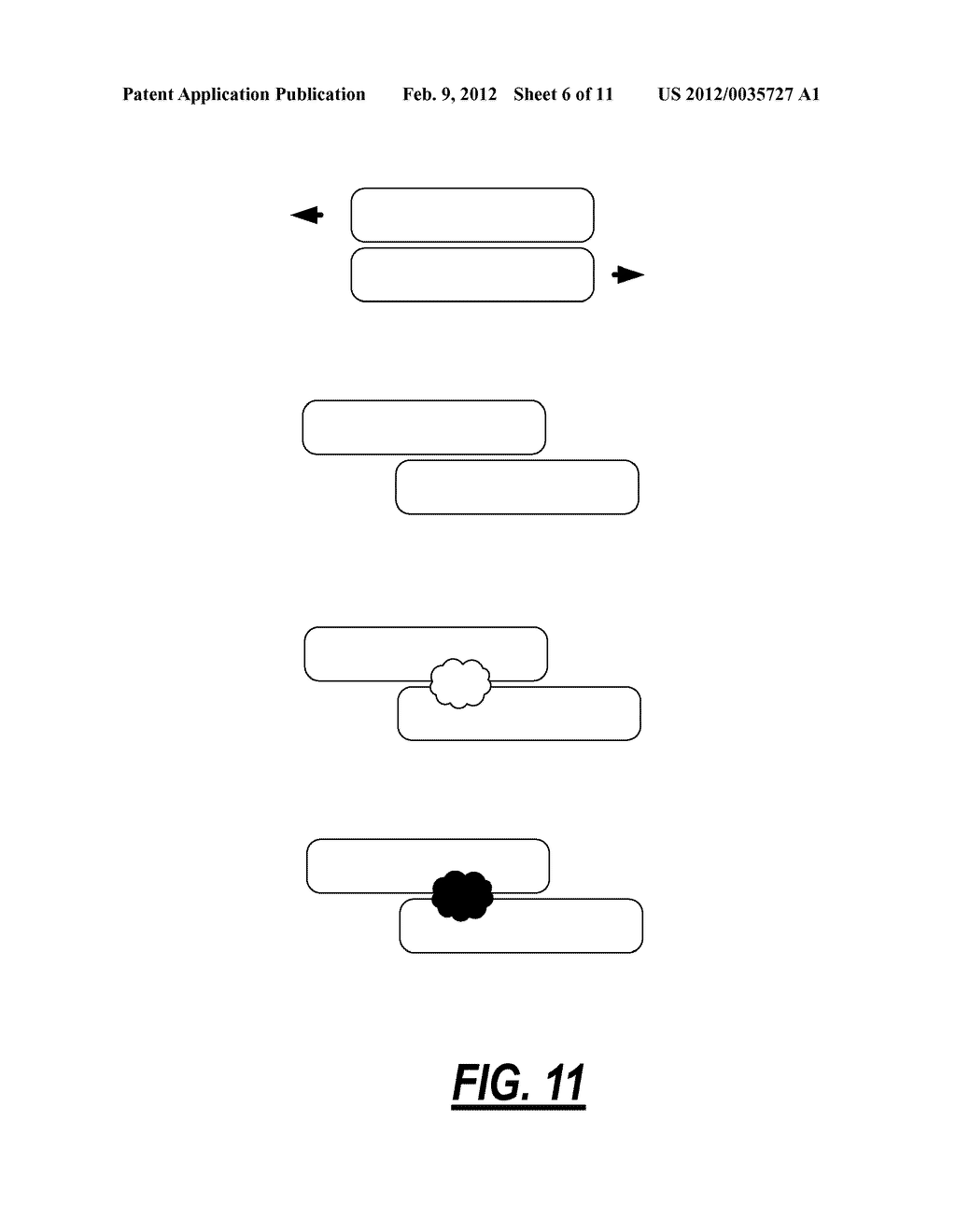 SURGICAL IMPLANT DEVICE FOR THE TRANSLATION AND FUSION OF A FACET JOINT OF     THE SPINE - diagram, schematic, and image 07