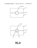 SURGICAL IMPLANT DEVICE FOR THE TRANSLATION AND FUSION OF A FACET JOINT OF     THE SPINE diagram and image