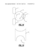 SURGICAL IMPLANT DEVICE FOR THE TRANSLATION AND FUSION OF A FACET JOINT OF     THE SPINE diagram and image