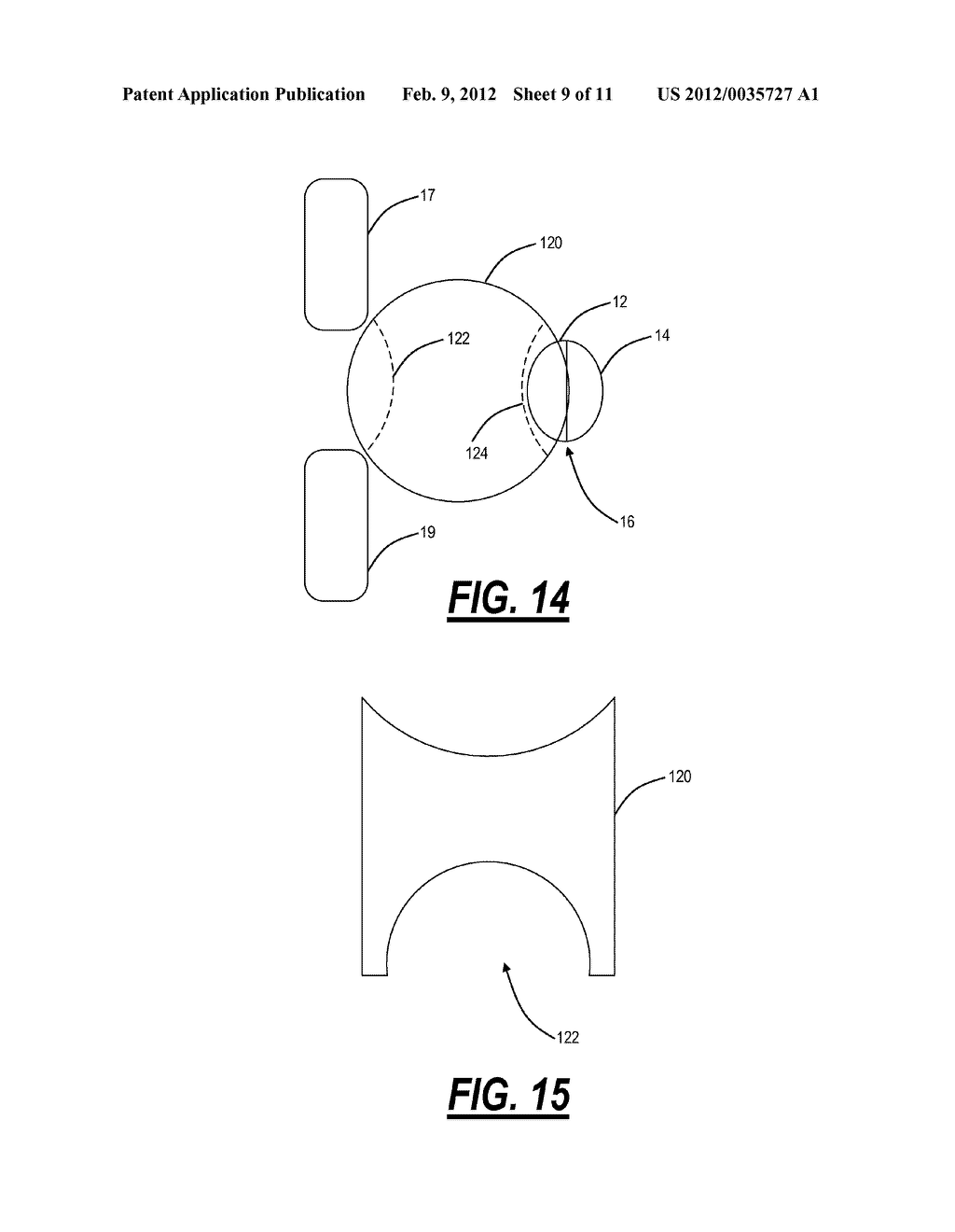SURGICAL IMPLANT DEVICE FOR THE TRANSLATION AND FUSION OF A FACET JOINT OF     THE SPINE - diagram, schematic, and image 10
