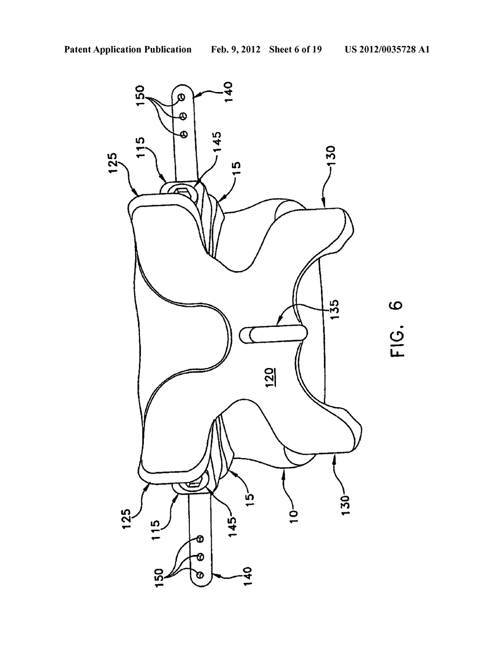 Prothesis For the Replacement of a Posterior Element of a Vertebra - diagram, schematic, and image 07