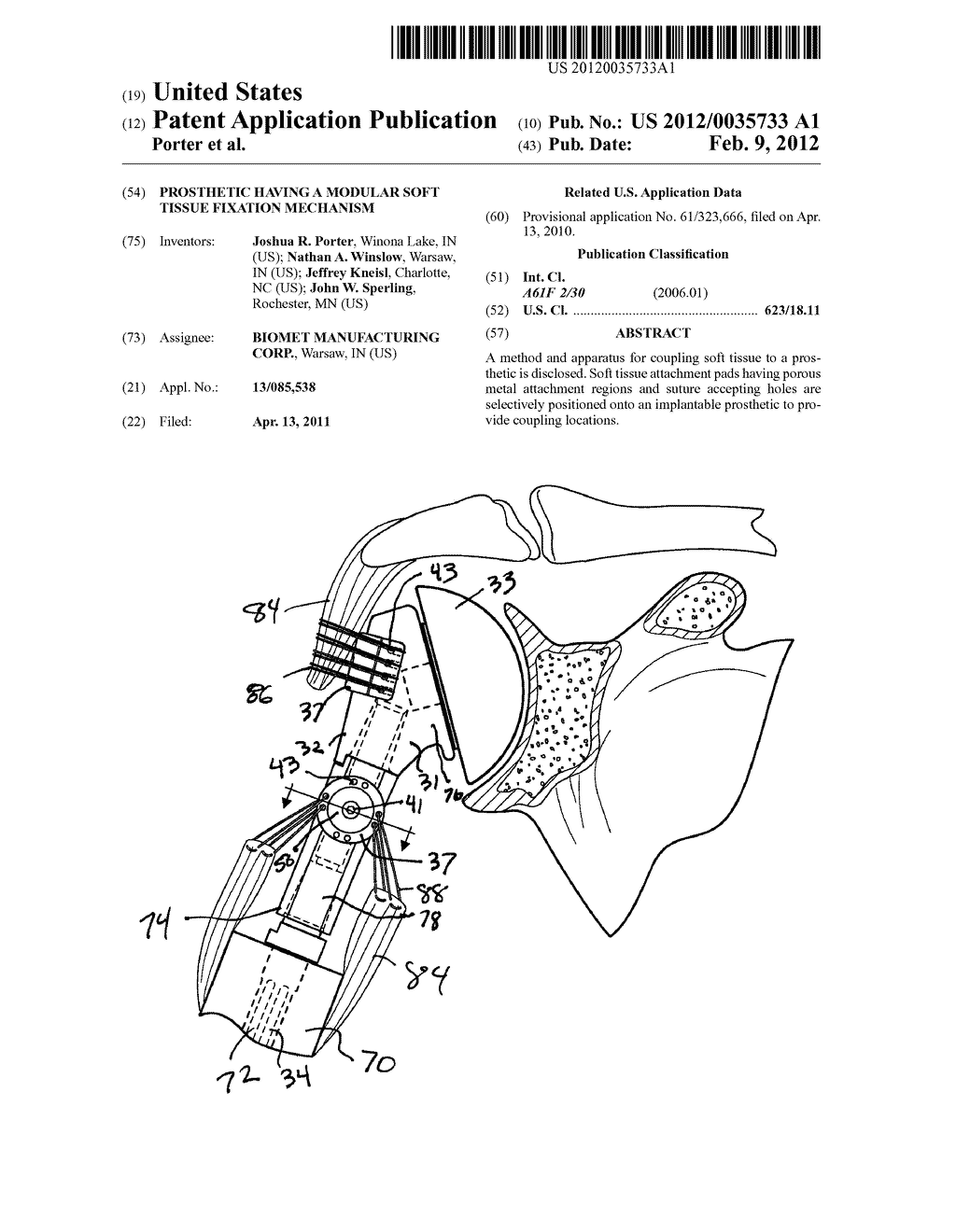 PROSTHETIC HAVING A MODULAR SOFT TISSUE FIXATION MECHANISM - diagram, schematic, and image 01