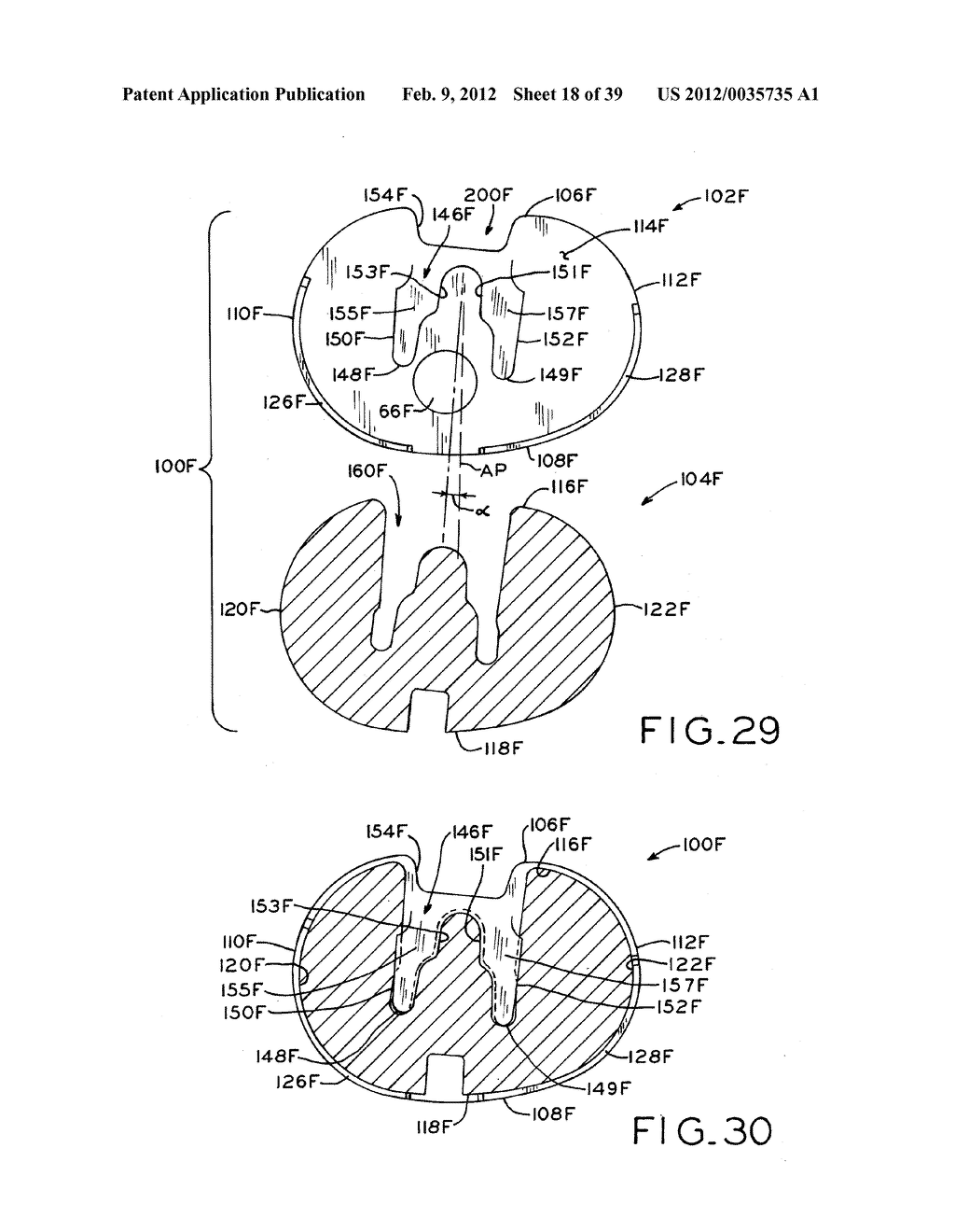 TIBIAL PROSTHESIS - diagram, schematic, and image 19