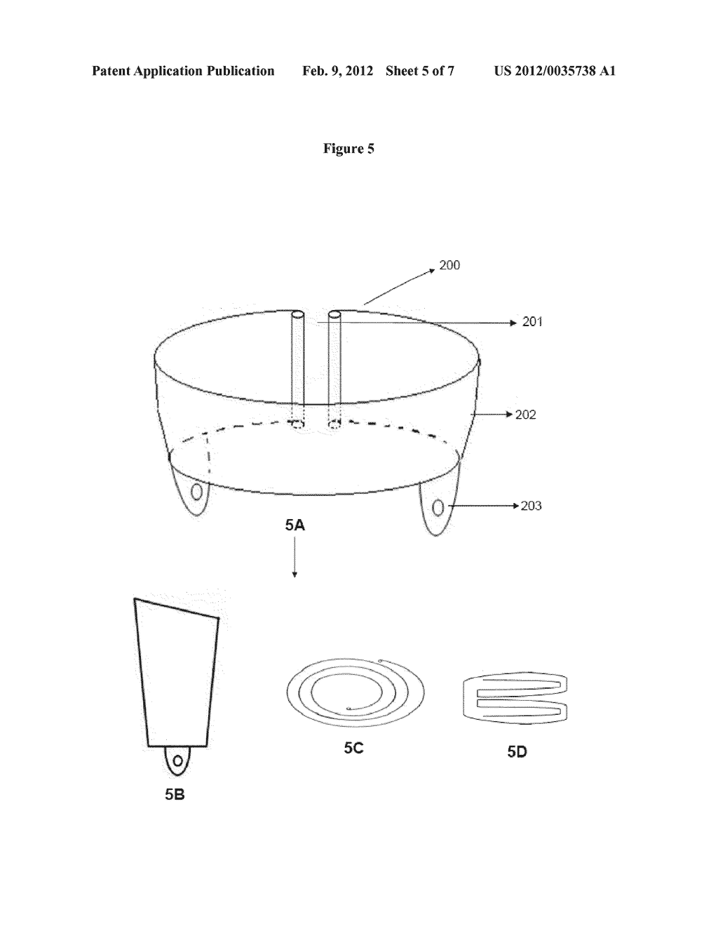 INTRAVITREOUS SELF ADAPTIVE STENT - diagram, schematic, and image 06